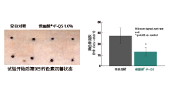 倍麗蘇®・F-QS(图4)